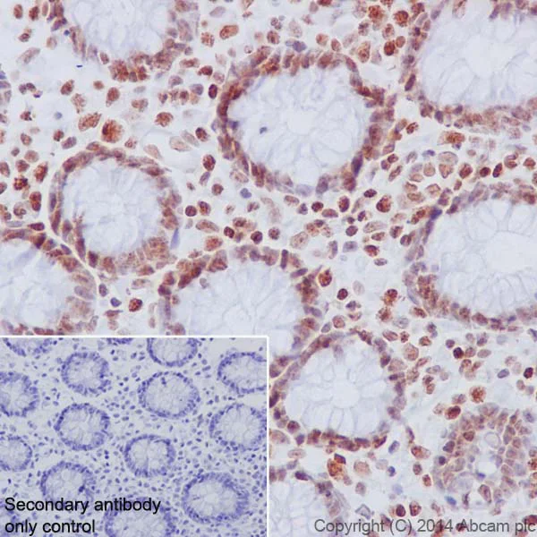 Immunohistochemistry (Formalin/PFA-fixed paraffin-embedded sections) - Anti-Histone H2A (phospho S1) + Histone H4 (phospho S1) antibody [EPR18184] (AB177309)