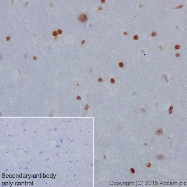 Immunohistochemistry (Formalin/PFA-fixed paraffin-embedded sections) - Anti-Histone H2A (phospho S1) + Histone H4 (phospho S1) antibody [EPR18184] (AB177309)