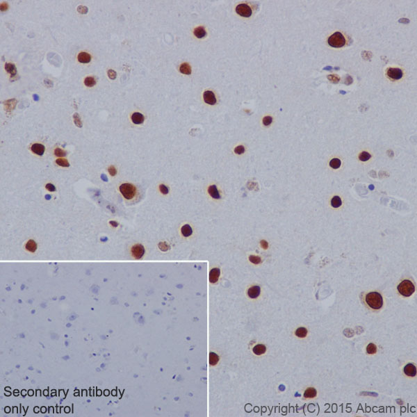 Immunohistochemistry (Formalin/PFA-fixed paraffin-embedded sections) - Anti-Histone H2A (phospho S1) + Histone H4 (phospho S1) antibody [EPR18184] (AB177309)