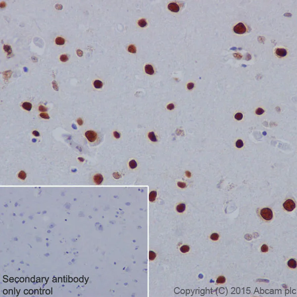 Immunohistochemistry (Formalin/PFA-fixed paraffin-embedded sections) - Anti-Histone H2A (phospho S1) + Histone H4 (phospho S1) antibody [EPR18184] (AB177309)