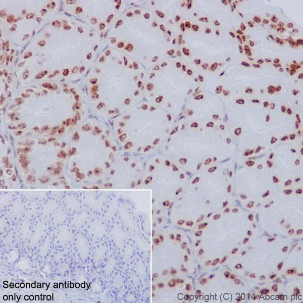 Immunohistochemistry (Formalin/PFA-fixed paraffin-embedded sections) - Anti-Histone H2A (phospho S1) + Histone H4 (phospho S1) antibody [EPR18184] (AB177309)