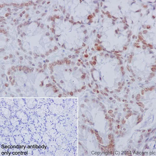 Immunohistochemistry (Formalin/PFA-fixed paraffin-embedded sections) - Anti-Histone H2A (phospho S1) + Histone H4 (phospho S1) antibody [EPR18184] (AB177309)