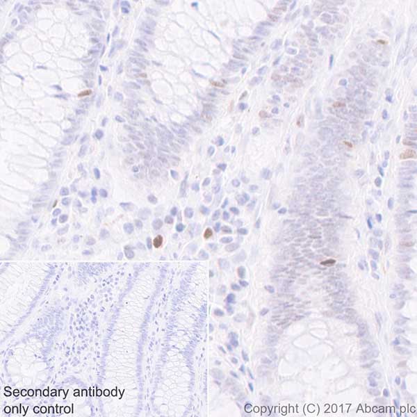 Immunohistochemistry (Formalin/PFA-fixed paraffin-embedded sections) - Anti-Histone H2A (phospho T120) antibody [EPR17492] - BSA and Azide free (AB249963), expandable thumbnail