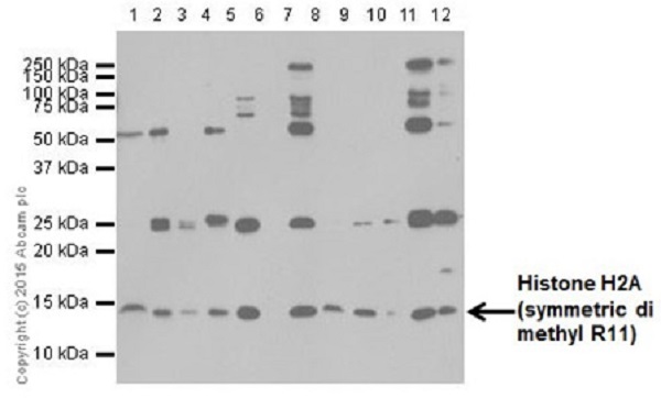 Western blot - Anti-Histone H2A (symmetric di methyl R11) antibody [E18766] (AB195464)