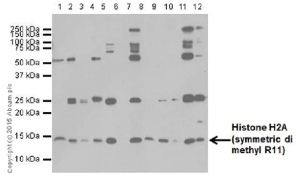 Western blot - Anti-Histone H2A (symmetric di methyl R11) antibody [E18766] - BSA and Azide free (AB251207)