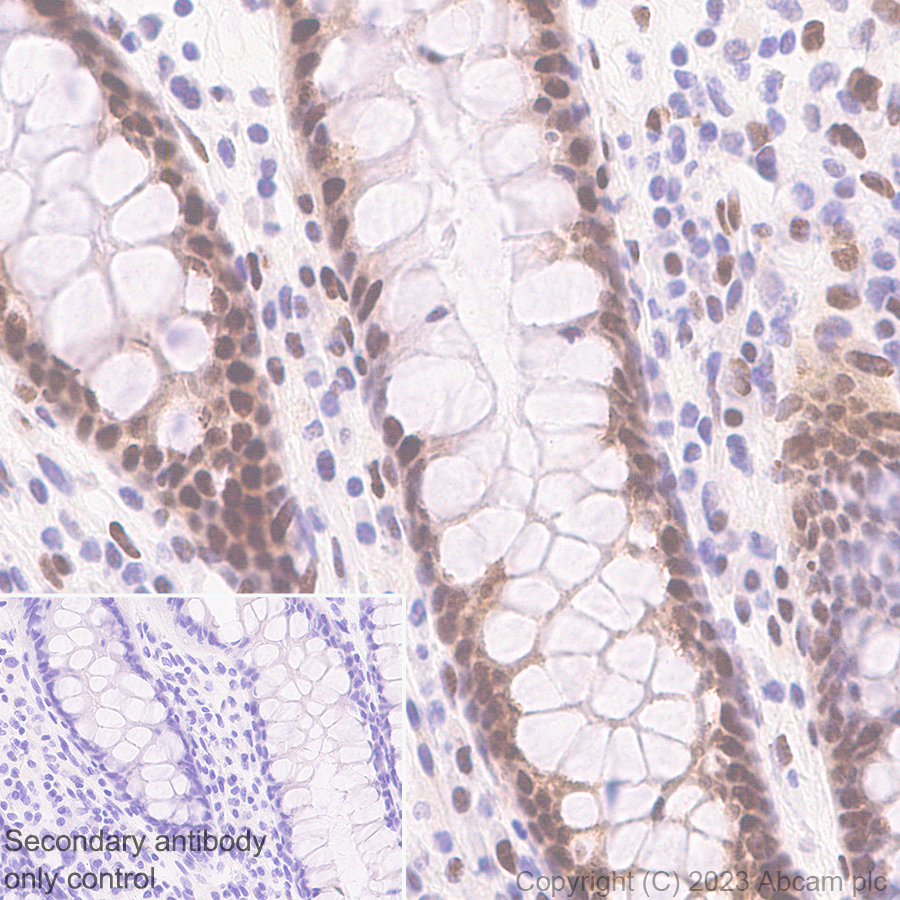 Immunohistochemistry (Formalin/PFA-fixed paraffin-embedded sections) - Anti-Histone H2A (symmetric di methyl R3) + Histone H4 (symmetric di methyl R3) antibody [EPR27303-14] (AB309354), expandable thumbnail