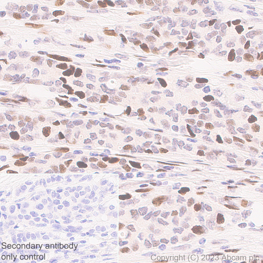 Immunohistochemistry (Formalin/PFA-fixed paraffin-embedded sections) - Anti-Histone H2A (symmetric di methyl R3) + Histone H4 (symmetric di methyl R3) antibody [EPR27303-14] (AB309354), expandable thumbnail