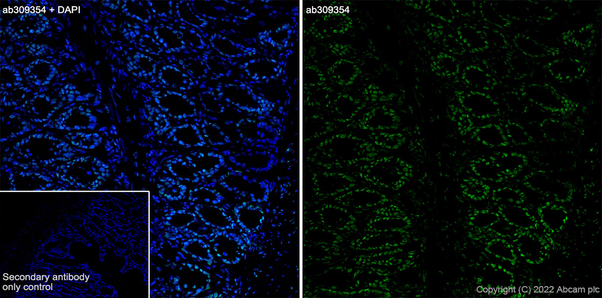 Immunohistochemistry (Frozen sections) - Anti-Histone H2A (symmetric di methyl R3) + Histone H4 (symmetric di methyl R3) antibody [EPR27303-14] (ab309354), expandable thumbnail