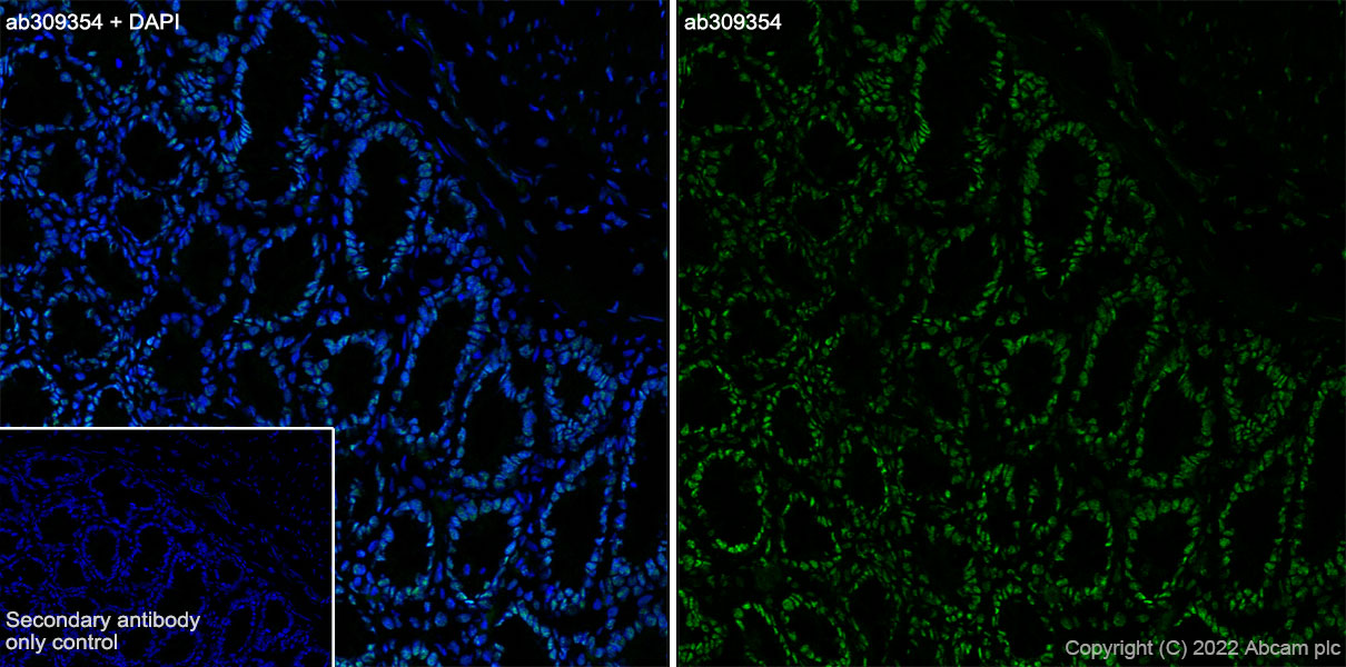 Immunohistochemistry (Frozen sections) - Anti-Histone H2A (symmetric di methyl R3) + Histone H4 (symmetric di methyl R3) antibody [EPR27303-14] (ab309354), expandable thumbnail