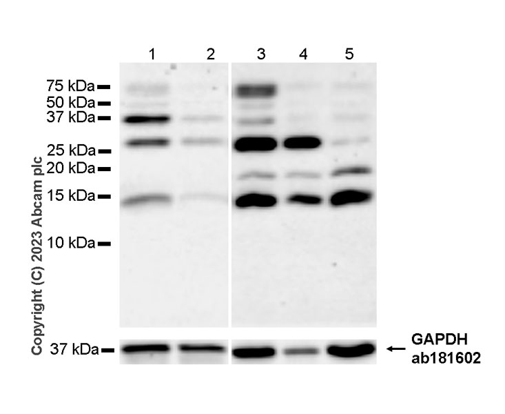 Western blot - Anti-Histone H2A (symmetric di methyl R3) + Histone H4 (symmetric di methyl R3) antibody [EPR27303-14] (AB309354), expandable thumbnail