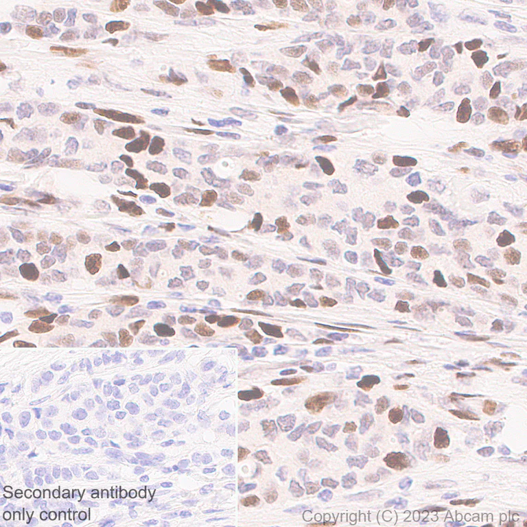 Immunohistochemistry (Formalin/PFA-fixed paraffin-embedded sections) - Anti-Histone H2A (symmetric di methyl R3) + Histone H4 (symmetric di methyl R3) antibody [EPR27303-14] (AB309354)
