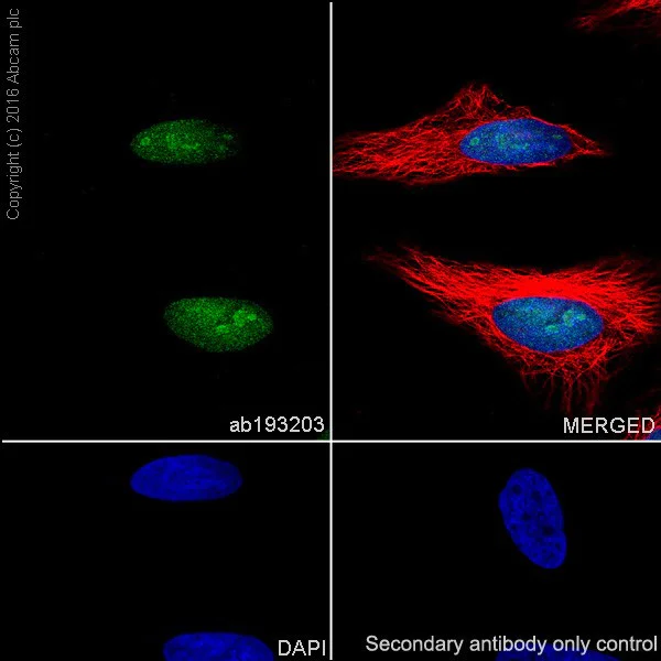 Immunocytochemistry/ Immunofluorescence - Anti-Histone H2A (ubiquityl K119) antibody [EPR19800] (AB193203)