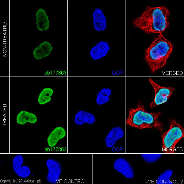 Immunocytochemistry/ Immunofluorescence - Anti-Histone H2A.X (acetyl K5) + Histone H2A (acetyl K5) antibody [EPR17589] - ChIP Grade (AB177863)