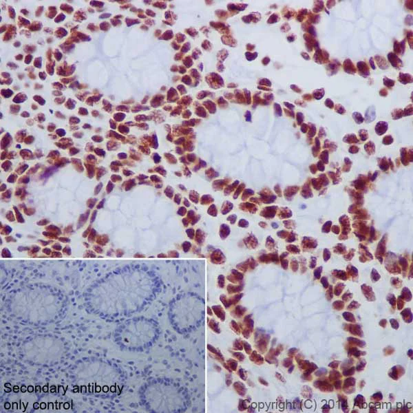 Immunohistochemistry (Formalin/PFA-fixed paraffin-embedded sections) - Anti-Histone H2A.X (acetyl K5) + Histone H2A (acetyl K5) antibody [EPR17589] - ChIP Grade (AB177863)