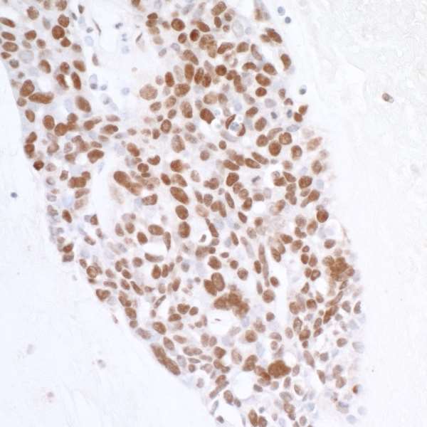 Immunohistochemistry (Formalin/PFA-fixed paraffin-embedded sections) - Anti-Histone H2A.X antibody (AB11175), expandable thumbnail