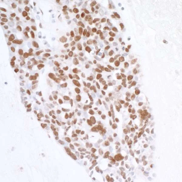 Immunohistochemistry (Formalin/PFA-fixed paraffin-embedded sections) - Anti-Histone H2A.X antibody (AB11175)
