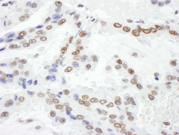 Immunohistochemistry (Formalin/PFA-fixed paraffin-embedded sections) - Anti-Histone H2A.X antibody (AB140498)
