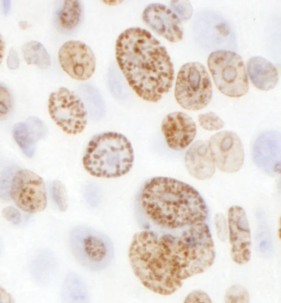 Immunohistochemistry (Formalin/PFA-fixed paraffin-embedded sections) - Anti-Histone H2A.X antibody (AB140498)