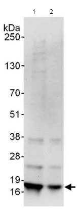 Western blot - Anti-Histone H2A.X antibody (AB140498)