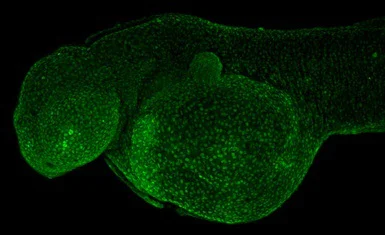IHC - Wholemount - Anti-Histone H2A.X antibody (AB209980)