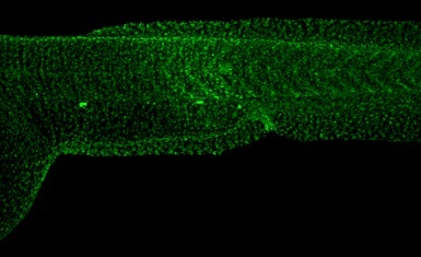IHC - Wholemount - Anti-Histone H2A.X antibody (AB209980)