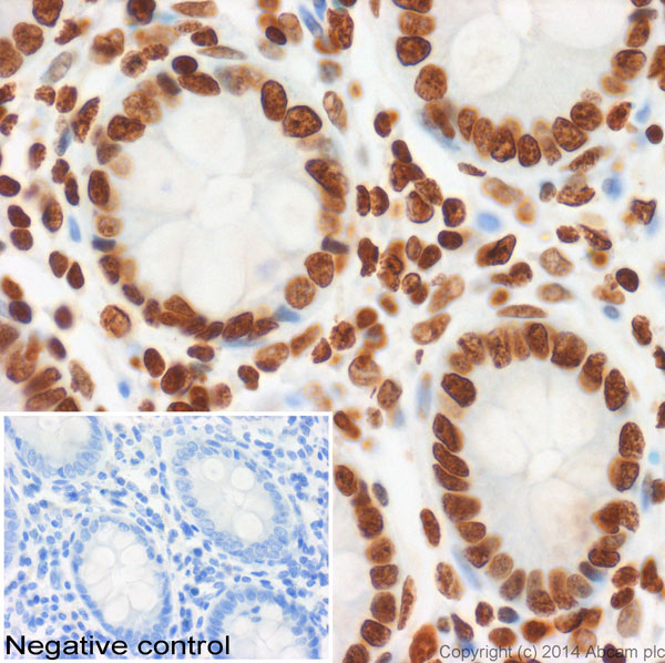 Immunohistochemistry (Formalin/PFA-fixed paraffin-embedded sections) - Anti-Histone H2A.X antibody - ChIP Grade (AB20669), expandable thumbnail