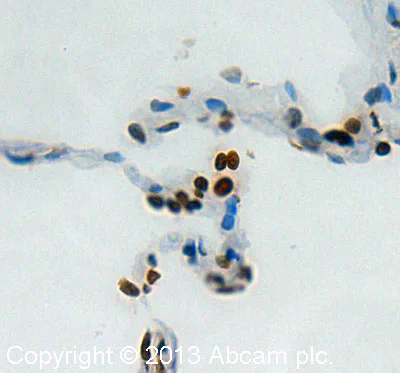 Immunohistochemistry (Formalin/PFA-fixed paraffin-embedded sections) - Anti-Histone H2A.X antibody - ChIP Grade (AB20669)