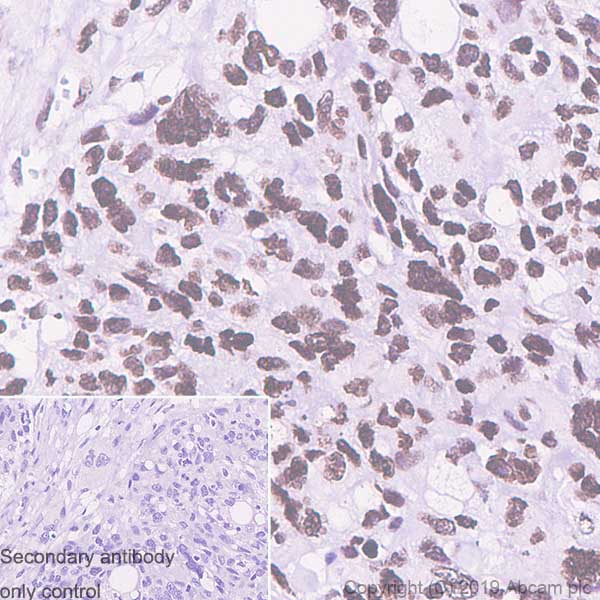 Immunohistochemistry (Formalin/PFA-fixed paraffin-embedded sections) - Anti-Histone H2A.X antibody [EPR22820-23] - ChIP Grade (ab229914), expandable thumbnail