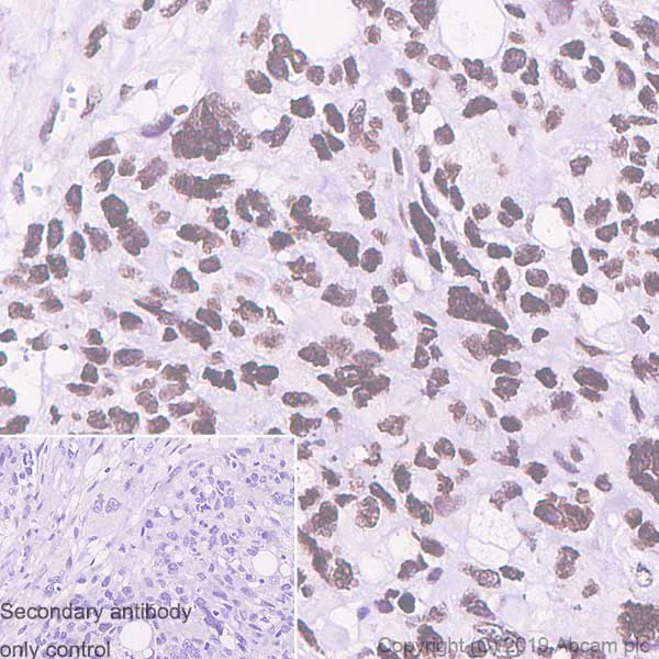 Immunohistochemistry (Formalin/PFA-fixed paraffin-embedded sections) - Anti-Histone H2A.X antibody [EPR22820-23] - ChIP Grade - BSA and Azide free (AB256544)