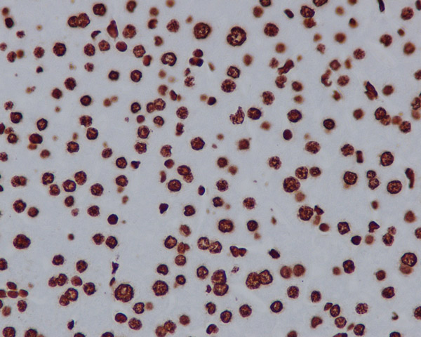 Immunohistochemistry (Formalin/PFA-fixed paraffin-embedded sections) - Anti-Histone H2A.X antibody [EPR895] - BSA and Azide free (AB217838), expandable thumbnail
