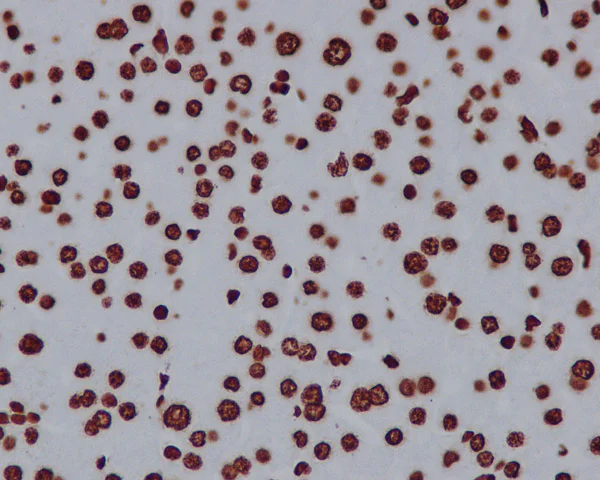 Immunohistochemistry (Formalin/PFA-fixed paraffin-embedded sections) - Anti-Histone H2A.X antibody [EPR895] - Nuclear Marker (AB124781)