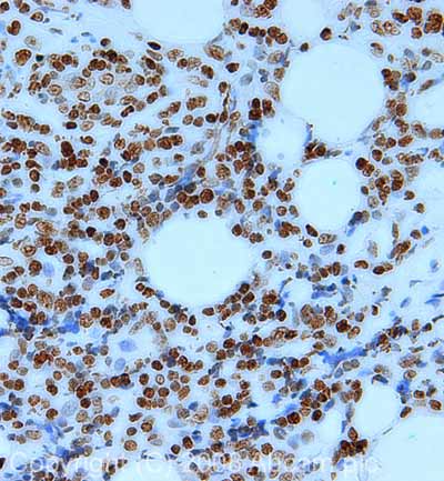 Immunohistochemistry (Formalin/PFA-fixed paraffin-embedded sections) - Anti-Histone H2A.X antibody - Nuclear Marker (AB10475)