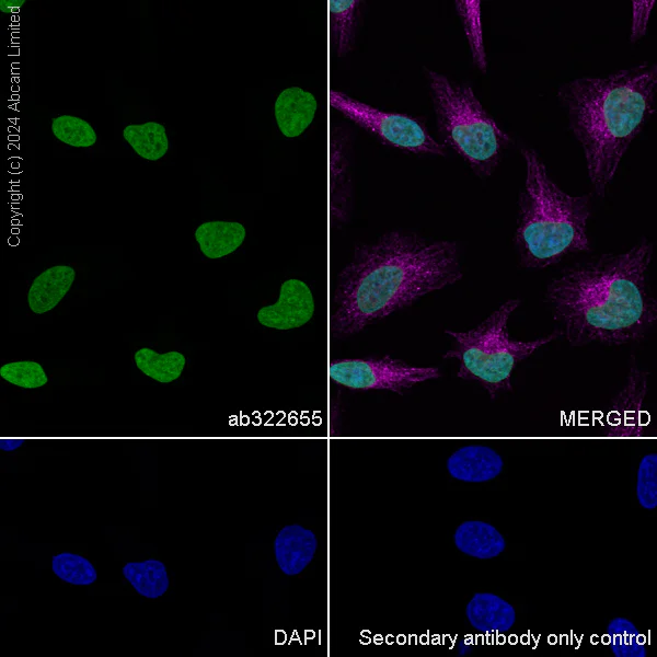 Immunocytochemistry/ Immunofluorescence - Anti-Histone H2A.X antibody [RM1271] (AB322655)