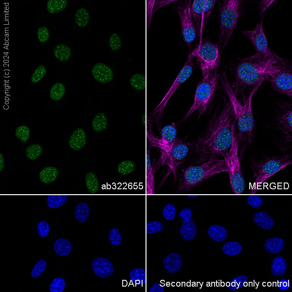 Immunocytochemistry/ Immunofluorescence - Anti-Histone H2A.X antibody [RM1271] (AB322655)
