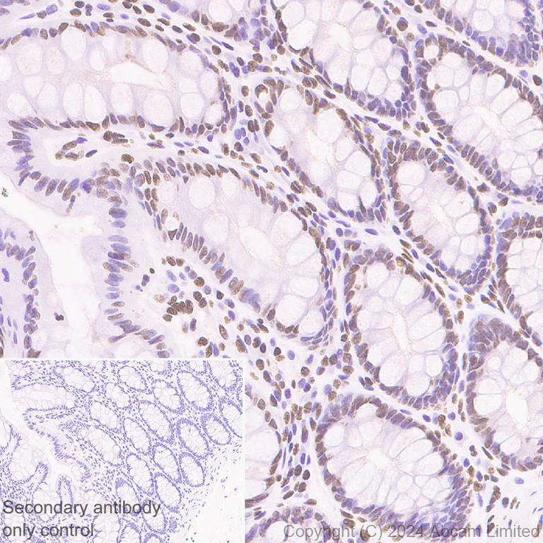 Immunohistochemistry (Formalin/PFA-fixed paraffin-embedded sections) - Anti-Histone H2A.X antibody [RM1271] (AB322655)