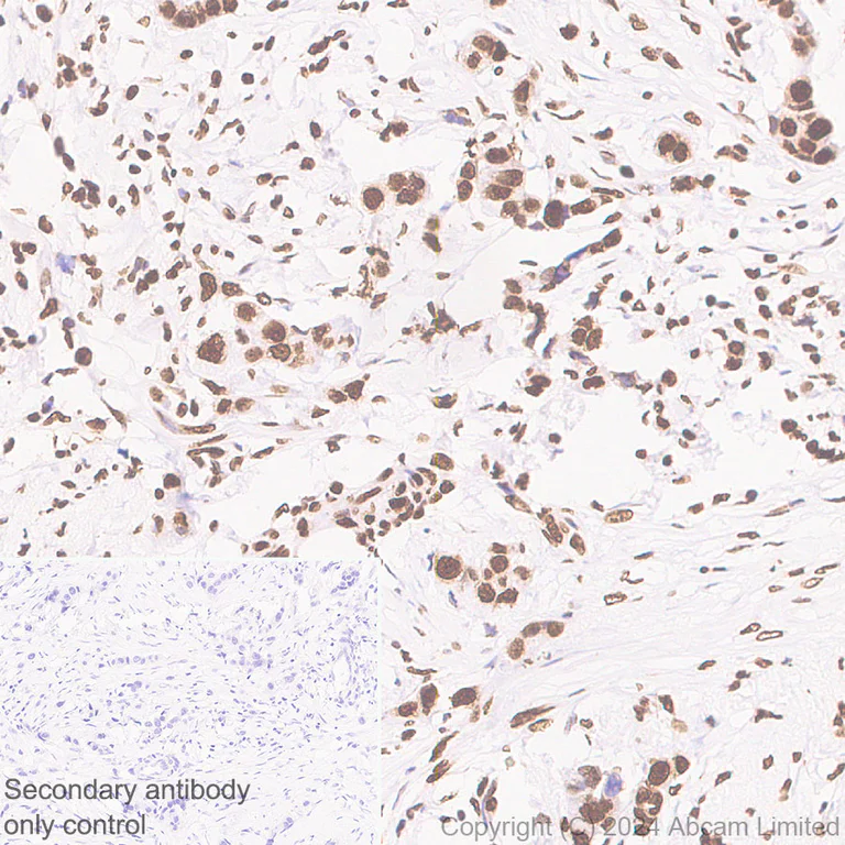 Immunohistochemistry (Formalin/PFA-fixed paraffin-embedded sections) - Anti-Histone H2A.X antibody [RM1271] (AB322655)
