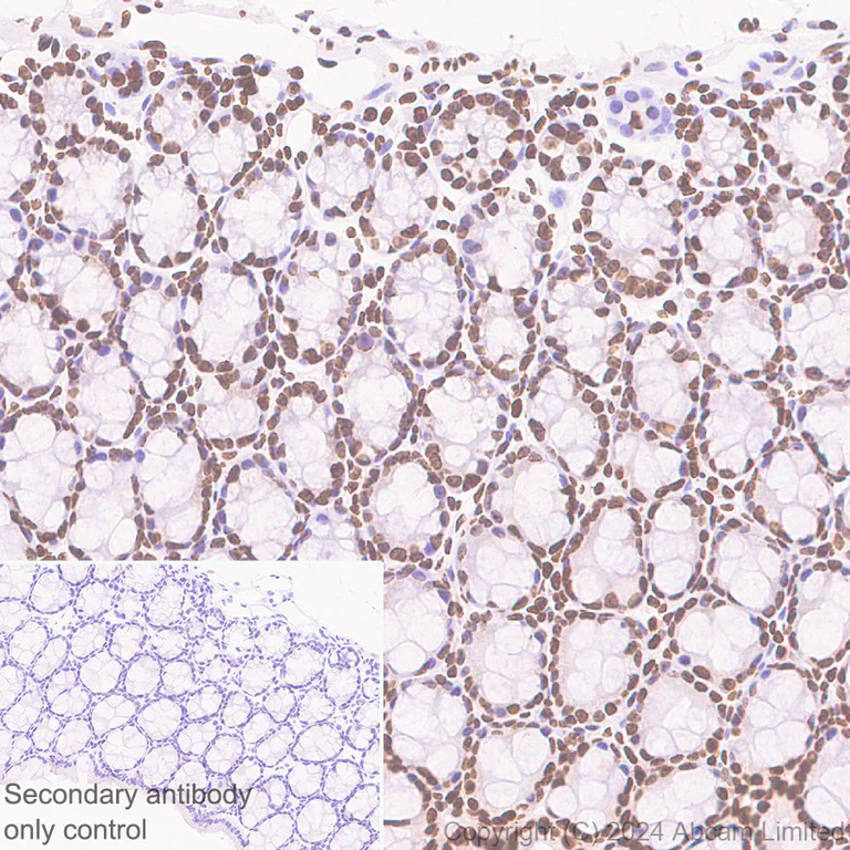 Immunohistochemistry (Formalin/PFA-fixed paraffin-embedded sections) - Anti-Histone H2A.X antibody [RM1271] (AB322655)