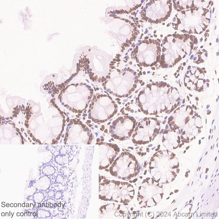 Immunohistochemistry (Formalin/PFA-fixed paraffin-embedded sections) - Anti-Histone H2A.X antibody [RM1271] (AB322655)