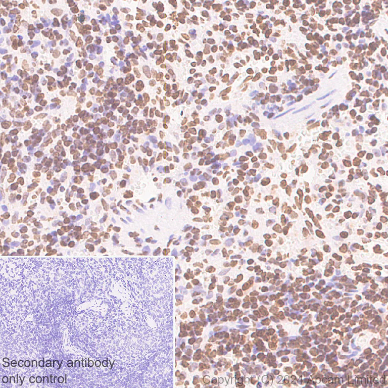 Immunohistochemistry (Formalin/PFA-fixed paraffin-embedded sections) - Anti-Histone H2A.X antibody [RM1271] (AB322655)