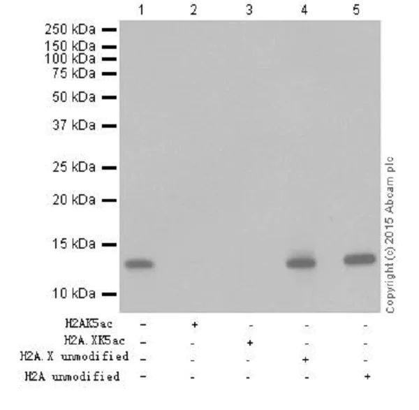 Western blot - Anti-Histone H2A.X+Histone H2A (acetyl K5) antibody [EPR17589] - BSA and Azide free (AB250006)