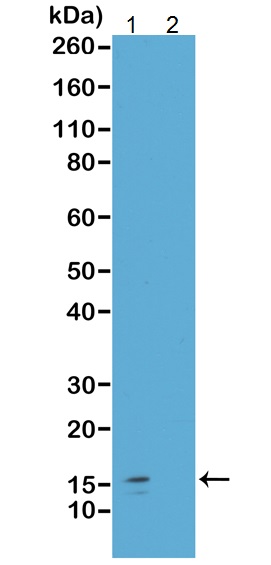 Anti-Histone H2A.Z (acetyl K7) antibody [RM222]