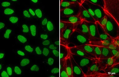 Immunocytochemistry/ Immunofluorescence - Anti-Histone H2A.Z antibody - ChIP Grade (AB97966)