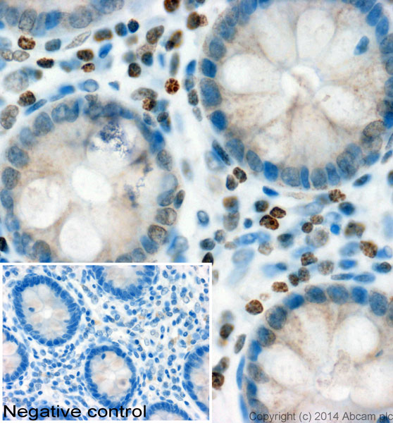 Immunohistochemistry (Formalin/PFA-fixed paraffin-embedded sections) - Anti-Histone H2A.Z antibody - ChIP Grade (AB97966), expandable thumbnail