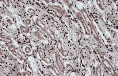 Immunohistochemistry (Formalin/PFA-fixed paraffin-embedded sections) - Anti-Histone H2A.Z antibody - ChIP Grade (AB97966)