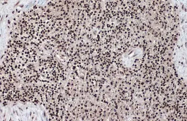 Immunohistochemistry (Formalin/PFA-fixed paraffin-embedded sections) - Anti-Histone H2A.Z antibody - ChIP Grade (AB97966)