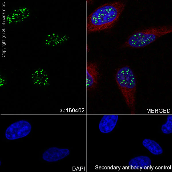 Immunocytochemistry/ Immunofluorescence - Anti-Histone H2A.Z antibody [EPR6171(2)(B)] - BSA and Azide free (AB208691)