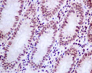 Immunohistochemistry (Formalin/PFA-fixed paraffin-embedded sections) - Anti-Histone H2A.Z antibody [EPR6171(2)(B)] - BSA and Azide free (AB208691)