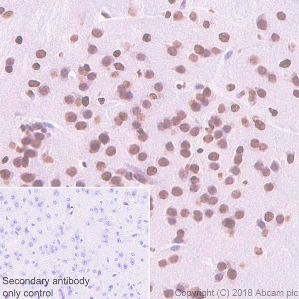 Immunohistochemistry (Formalin/PFA-fixed paraffin-embedded sections) - Anti-Histone H2A.Z antibody [EPR6171(2)(B)] - BSA and Azide free (AB208691)