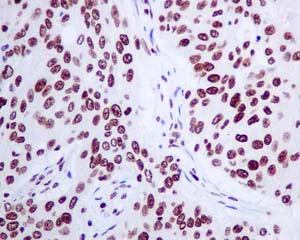 Immunohistochemistry (Formalin/PFA-fixed paraffin-embedded sections) - Anti-Histone H2A.Z antibody [EPR6171(2)(B)] - BSA and Azide free (AB208691)