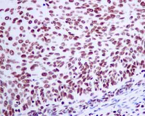 Immunohistochemistry (Formalin/PFA-fixed paraffin-embedded sections) - Anti-Histone H2A.Z antibody [EPR6171(2)(B)] - BSA and Azide free (AB208691)
